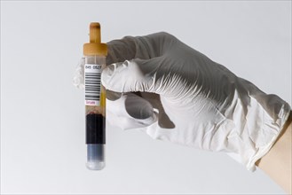 Laboratory assistant's hand holding a monovette containing serum