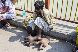 A beggar with Elephantiasis at his feet is sitting at Harki Pauri Ghat at the holy river Ganges