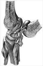 Sectional view of human knee with meniscus