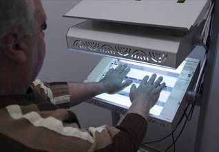 Patient has his hands in a phototherapy box for an irradiation treatment