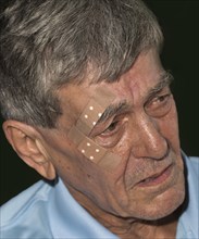 Elderly man with plasters on his face