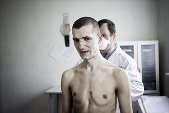 Tuberculosis and HIV in Moldova