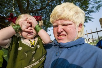 Two albinos covering and closing their sensitive eyes from the sunlight