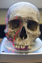 A scanner making a 3D photograph of the skull of an unidentified migrant