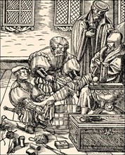 Amputation of a leg in the 16th century