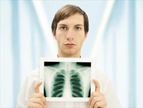 Man with a serious face holding an iPad with a radiographic image of a lung