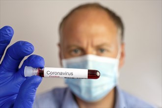 Man wearing protective mask and showing positive result of his coronavirus test