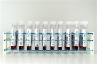 Positive results of corona virus tests