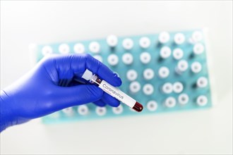 Laboratory physician holding a test tube with positive results of the coronavirus test