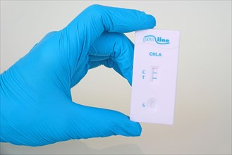 Quick test Chlamydia of the company ProLine