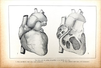 The Heart and the Large Cardiac Vessels