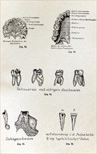 The teeth and their diseases