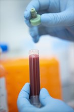 Medical laboratory assistant holding a tube with blood