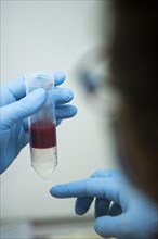 Medical laboratory assistant holding a centrifuge tube with blood