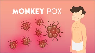 Illustration of monkeypox virus