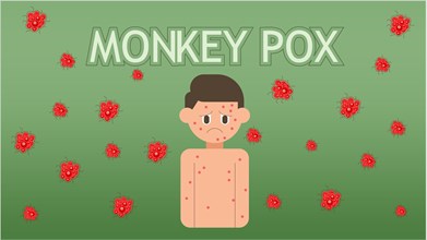 Monkeypox concept