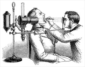 Historical Illustration of the Medication of a Larynx, Viewing with Light