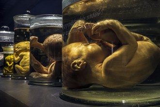 Collection of glass jars with foetuses preserved in formalin at different stages of growth