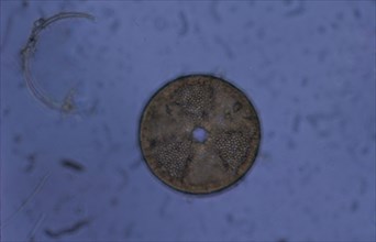 Acrinoptychus senarius living in plankton x130 magnification