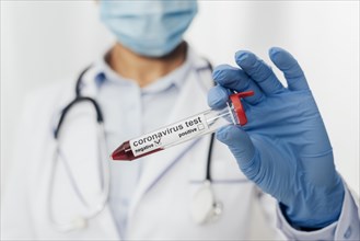 Close up doctor holding coronavirus test