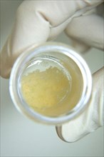 Stem cells inside a glass jar