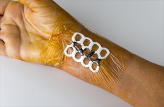 Post-operative wound dressing with honeycomb wound pad and bacteria-proof film