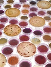 Coliform Bacteria Growing in Petri Dishes