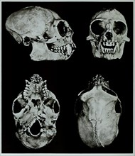 Skull bone
