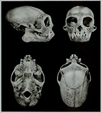 Skull bone