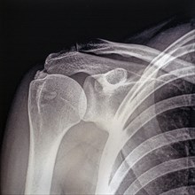 Old mid 20th century X-ray photograph