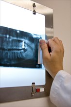 Doctor checking panoramic x-ray in his office