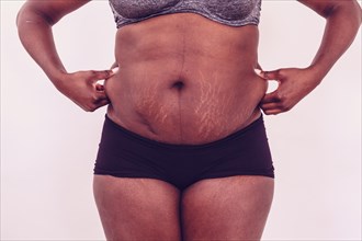 Fat woman with stretch marks on belly