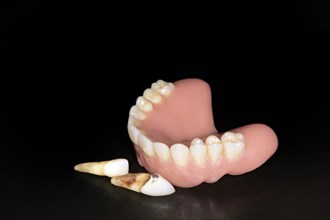 Denture upper jaw made of plastic with pulled teeth