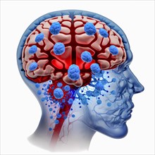 Icon image of human transparent head with brain and dementia