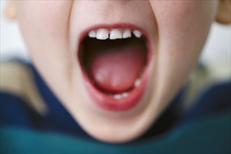 Symbol photo. A boy screams while showing his open mouth. Berlin