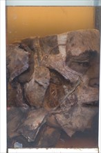 Closeup of a dead man's head preserved in a glass jar