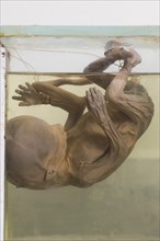 Fetus preserved in a glass jar