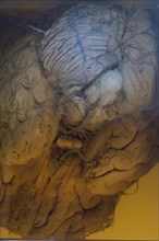 Human brain embalmed in a glass jar