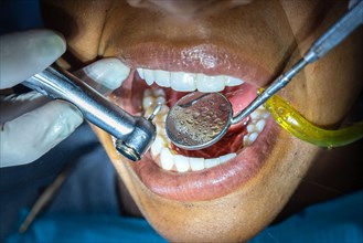 Dentist examining a patient's teeth with dental tools