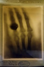 Facsimile of 1895 radiograph of the hand of Wilhelm Conrad Röntgen's wife