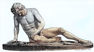 A Dying Gaul