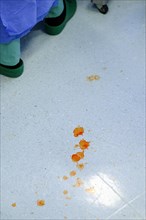 Blood spatter on the floor of an operating theatre in a hospital