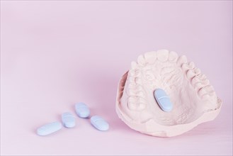 Dental model plaster cast pills pink background