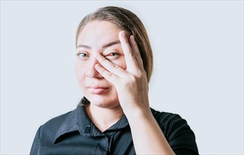 Person with irritated eyes. People with eye pain isolated. woman with conjunctivitis on white background. Close up of girl with eye strain