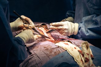 A detailed shot capturing a surgeon's hands skillfully using a scalpel in the operating room during scoliosis surgery at a hospital. Hospital and operating room