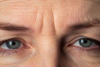 Close up of fron lines wrinkles between eyes of middle aged or elderly woman. KI generiert,
