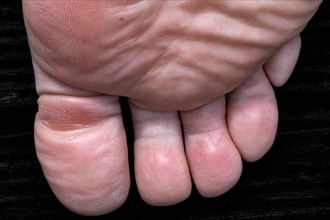 Close-up of a human foot from above, focussing on the toes and skin texture