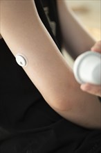 Child holding a setting aid for a glucose sensor, the sensor has been attached to the child's arm,