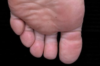 Close-up of a human foot from below with a view of the toes