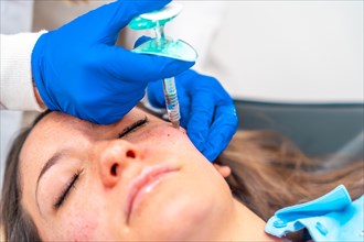 Doctor injecting hyaluronic acid injection to the face of a woman during a rejuvenation beauty